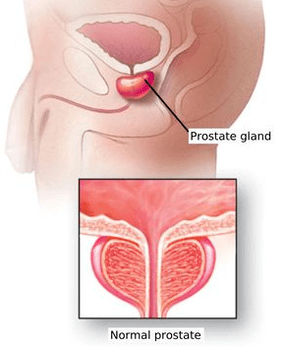 Gizonezko prostatako egitura eskematikoa